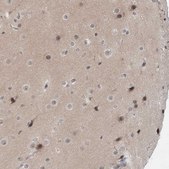 Anti-EXOSC10 antibody produced in rabbit Prestige Antibodies&#174; Powered by Atlas Antibodies, affinity isolated antibody, buffered aqueous glycerol solution, ab1