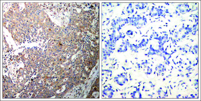 Anti-KRT18 (Ab-33) antibody produced in rabbit affinity isolated antibody