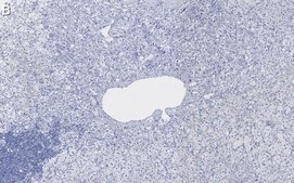 Anti-Dopamine &#946; Hydroxylase Antibody, clone 2B11 ZooMAb&#174; Rabbit Monoclonal recombinant, expressed in HEK 293 cells