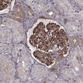 Anti-MYH9 antibody produced in rabbit Prestige Antibodies&#174; Powered by Atlas Antibodies, affinity isolated antibody, buffered aqueous glycerol solution