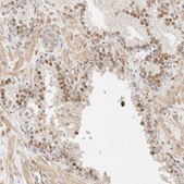 Anti-ARID5A antibody produced in rabbit Prestige Antibodies&#174; Powered by Atlas Antibodies, affinity isolated antibody, buffered aqueous glycerol solution