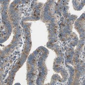 Anti-POR antibody produced in rabbit Prestige Antibodies&#174; Powered by Atlas Antibodies, affinity isolated antibody, buffered aqueous glycerol solution