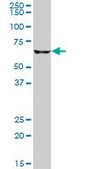Anti-CPT2 antibody produced in mouse purified immunoglobulin, buffered aqueous solution