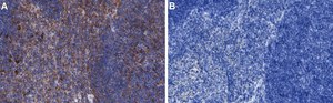 Anti-IL-17A Antibody, clone 3K22 ZooMAb&#174; Rabbit Monoclonal recombinant, expressed in HEK 293 cells