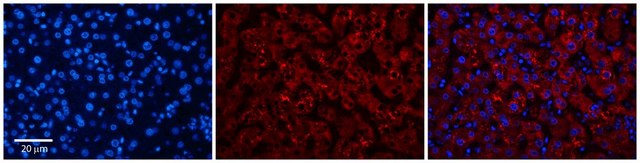 Anti-DPH1 antibody produced in rabbit affinity isolated antibody