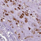 Anti-IGF2 antibody produced in rabbit Prestige Antibodies&#174; Powered by Atlas Antibodies, affinity isolated antibody, buffered aqueous glycerol solution