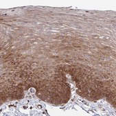 Anti-WNK1 antibody produced in rabbit Prestige Antibodies&#174; Powered by Atlas Antibodies, affinity isolated antibody, buffered aqueous glycerol solution