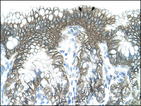 Anti-TARS antibody produced in rabbit IgG fraction of antiserum