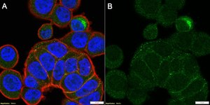 Anti-MMP-7 Antibody, clone 2B3 ZooMAb&#174; Rabbit Monoclonal recombinant, expressed in HEK 293 cells
