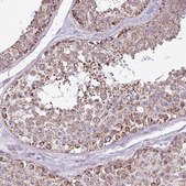 Anti-ALG8 antibody produced in rabbit Prestige Antibodies&#174; Powered by Atlas Antibodies, affinity isolated antibody, buffered aqueous glycerol solution