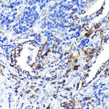 Anti-CD9 antibody produced in rabbit