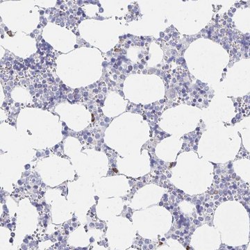 Anti-LRRC58 antibody produced in rabbit Prestige Antibodies&#174; Powered by Atlas Antibodies, affinity isolated antibody, buffered aqueous glycerol solution