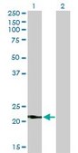 Monoclonal Anti-VSNL1 antibody produced in mouse clone 2F1-E3, purified immunoglobulin, buffered aqueous solution