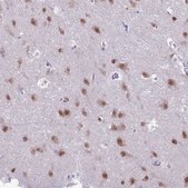 Anti-NOVA2 antibody produced in rabbit Prestige Antibodies&#174; Powered by Atlas Antibodies, affinity isolated antibody, buffered aqueous glycerol solution