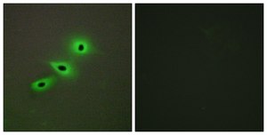 Anti-Cytochrome P450 19A1 antibody produced in rabbit affinity isolated antibody