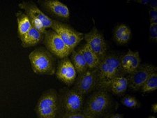 UM-SCC-105 Human Squamous Carcinoma Cell Line