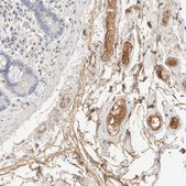 Anti-C8B antibody produced in rabbit Prestige Antibodies&#174; Powered by Atlas Antibodies, affinity isolated antibody, buffered aqueous glycerol solution