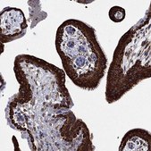 Anti-IGF2BP3 antibody produced in rabbit Prestige Antibodies&#174; Powered by Atlas Antibodies, affinity isolated antibody, buffered aqueous glycerol solution