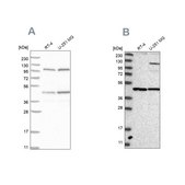 Anti-NUP43 antibody produced in rabbit Prestige Antibodies&#174; Powered by Atlas Antibodies, affinity isolated antibody, buffered aqueous glycerol solution, ab2