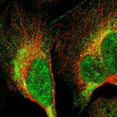 Anti-LRIT3 antibody produced in rabbit Prestige Antibodies&#174; Powered by Atlas Antibodies, affinity isolated antibody, buffered aqueous glycerol solution