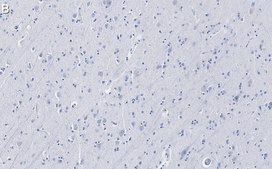 Anti-Tau Antibody, clone 3D20 ZooMAb&#174; Rabbit Monoclonal recombinant, expressed in HEK 293 cells