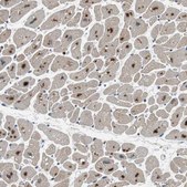Anti-USP28 antibody produced in rabbit Ab2, Prestige Antibodies&#174; Powered by Atlas Antibodies, affinity isolated antibody, buffered aqueous glycerol solution