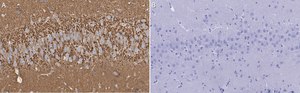 Anti-Synaptophysin Antibody, clone 2B21, ZooMAb&#174; Rabbit Monoclonal recombinant, expressed in HEK 293 cells