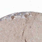 Anti-CACNB2 antibody produced in rabbit Prestige Antibodies&#174; Powered by Atlas Antibodies, affinity isolated antibody, buffered aqueous glycerol solution