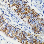 Anti-JAK1 Antibody, clone 7Q1B2, Rabbit Monoclonal