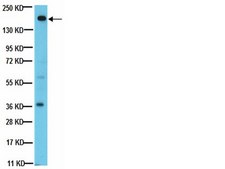 Anti-PDGFR Antibody, clone CH-3 clone CH-3, from mouse