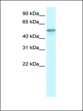 Anti-FOXO3A antibody produced in rabbit affinity isolated antibody