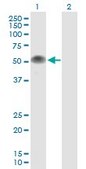 Anti-TP53 antibody produced in mouse purified immunoglobulin, buffered aqueous solution