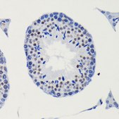 Anti-Phospho-Smad3-S423/S425 antibody produced in rabbit