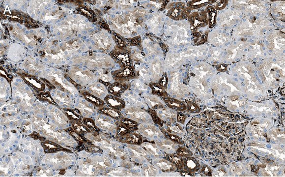 Anti-Filamin A Antibody, clone 1D12 ZooMAb&#174; Rabbit Monoclonal recombinant, expressed in HEK 293 cells