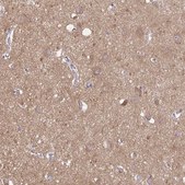 Anti-TLN2 Prestige Antibodies&#174; Powered by Atlas Antibodies, affinity isolated antibody