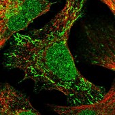 Anti-TNRC18 antibody produced in rabbit Prestige Antibodies&#174; Powered by Atlas Antibodies, affinity isolated antibody, buffered aqueous glycerol solution