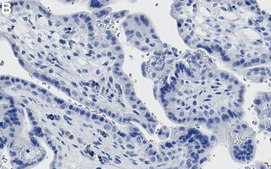 Anti-MLL2 Antibody, clone 3L17 ZooMAb&#174; Rabbit Monoclonal recombinant, expressed in HEK 293 cells