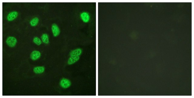 Anti-B-MYB antibody produced in rabbit affinity isolated antibody