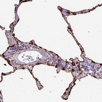 Anti-SFTPA1 antibody produced in rabbit Prestige Antibodies&#174; Powered by Atlas Antibodies, affinity isolated antibody, buffered aqueous glycerol solution