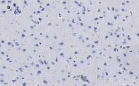 Anti-phospho-GluR1 (Ser831) Antibody, clone N453, ZooMAb&#174; Rabbit Monoclonal recombinant, expressed in HEK 293 cells