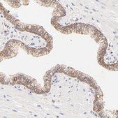 Anti-PTK7 antibody produced in rabbit Prestige Antibodies&#174; Powered by Atlas Antibodies, affinity isolated antibody, buffered aqueous glycerol solution