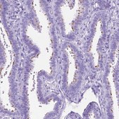 Anti-DNAH2 antibody produced in rabbit Prestige Antibodies&#174; Powered by Atlas Antibodies, affinity isolated antibody, buffered aqueous glycerol solution
