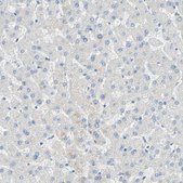Anti-MUC1 antibody produced in rabbit Prestige Antibodies&#174; Powered by Atlas Antibodies, affinity isolated antibody, buffered aqueous glycerol solution