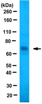 Anti-JMJD2E/KDM4E Antibody serum, from rabbit