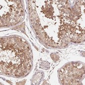 Anti-ANKRD13A antibody produced in rabbit Prestige Antibodies&#174; Powered by Atlas Antibodies, affinity isolated antibody, buffered aqueous glycerol solution