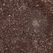 Anti-WDR37 antibody produced in rabbit Prestige Antibodies&#174; Powered by Atlas Antibodies, affinity isolated antibody, buffered aqueous glycerol solution