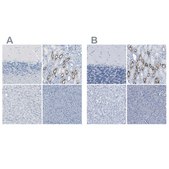 Anti-SLC12A1 antibody produced in rabbit Prestige Antibodies&#174; Powered by Atlas Antibodies, affinity isolated antibody, buffered aqueous glycerol solution