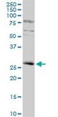 Anti-KLF16 antibody produced in rabbit purified immunoglobulin, buffered aqueous solution