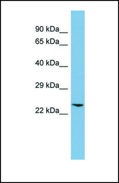 Anti-GLO1, (N-terminal) antibody produced in rabbit affinity isolated antibody