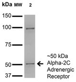 Monoclonal Anti-Versican - Rpe antibody produced in mouse clone S351-23, purified immunoglobulin
